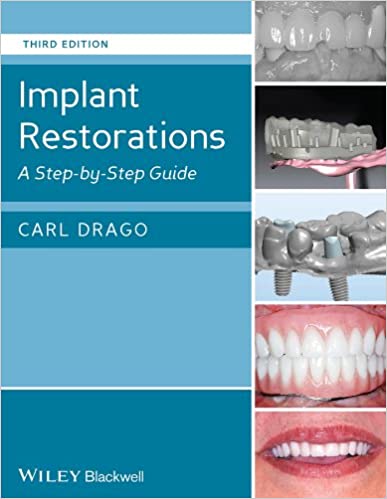 Implant Restorations: A Step-by-Step Guide (3rd Edition) - Orginal Pdf